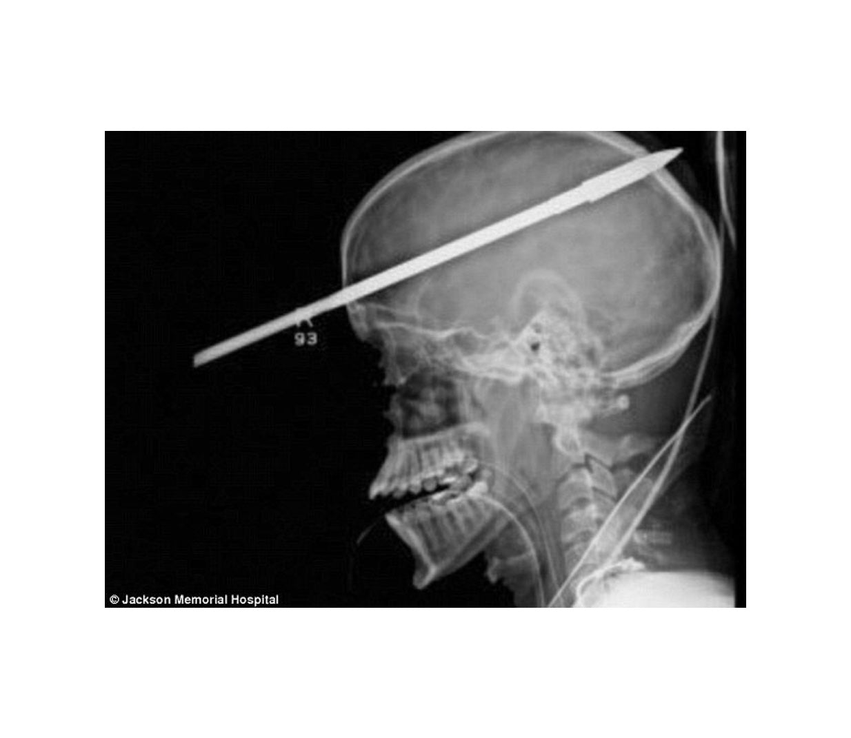 Speargun Safety - How to Handle a Speargun Safely